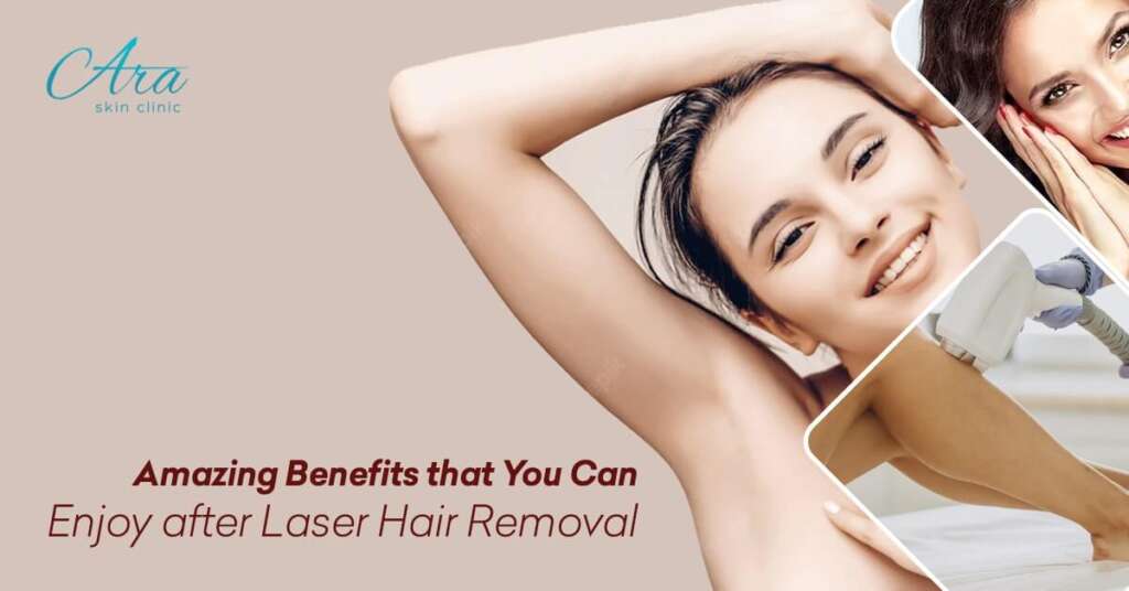 Amazing Benefits that You Can Enjoy after Laser Hair Removal