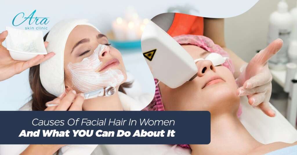 Causes Of Facial Hair In Women And What YOU Can Do About It