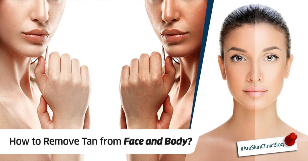 Skin whitening Treatment in Bangalore