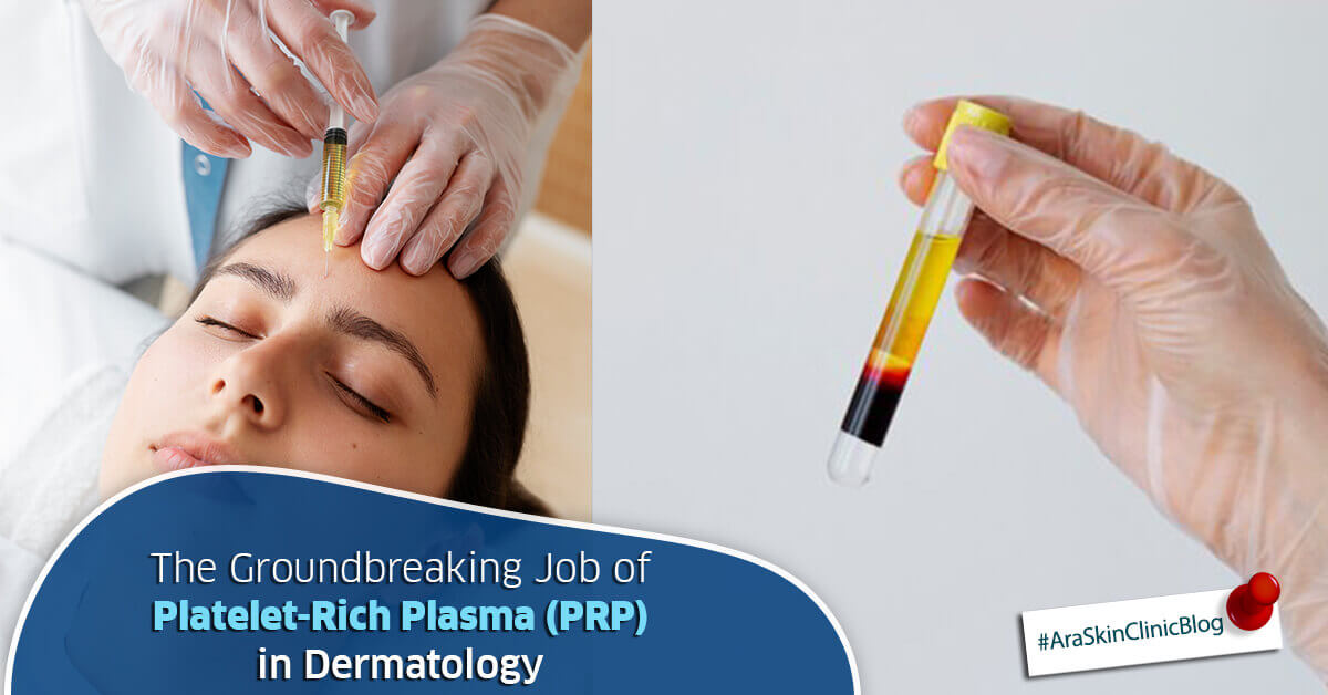 The Groundbreaking Job of Platelet-Rich Plasma (PRP) in Dermatology